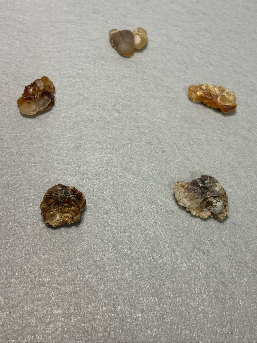 Lot of 5 Wa State Botryoidal Chalcedony/ Nodules Eyes/Agate Rough Specimens